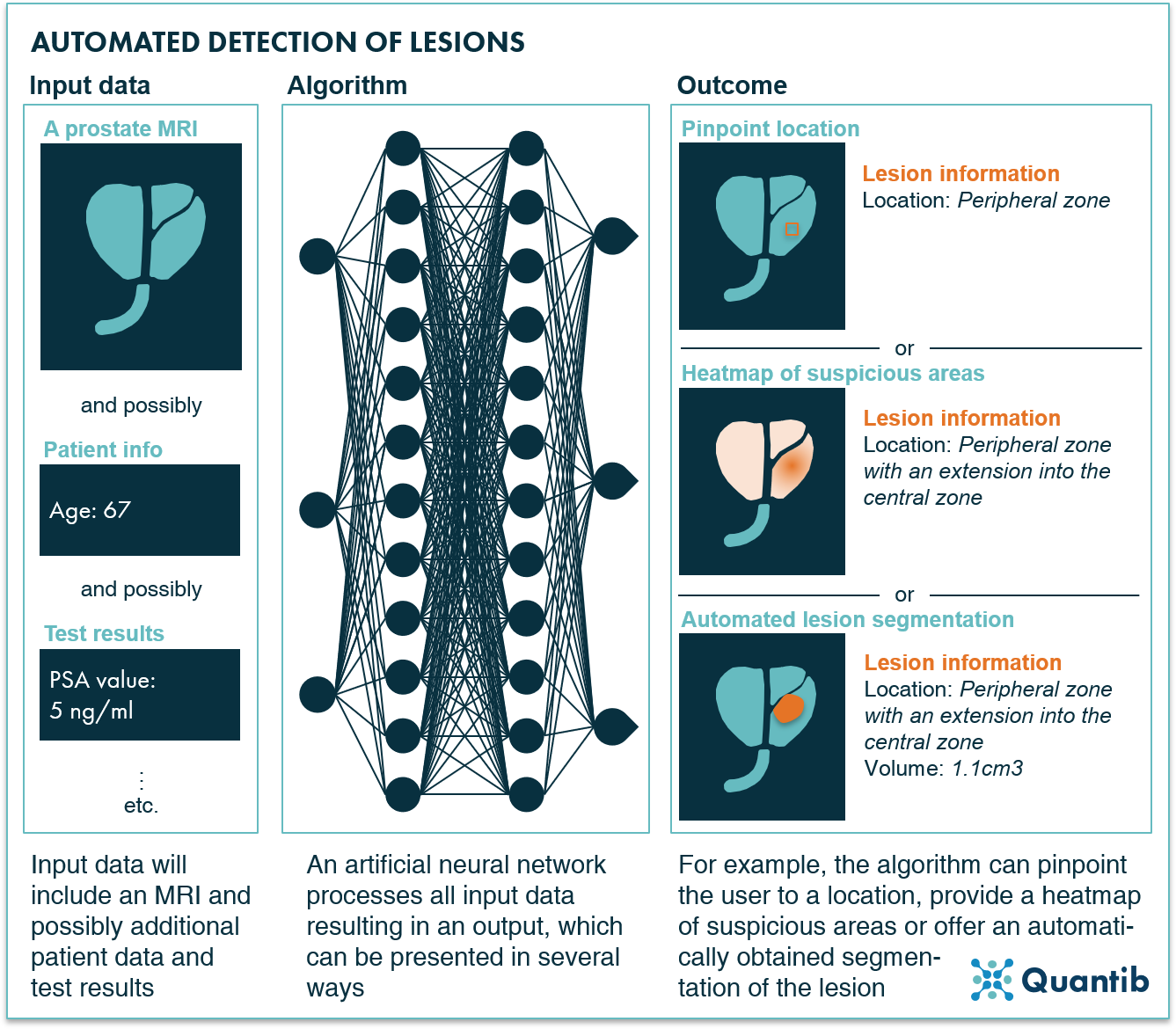 The Ultimate Guide To AI In Prostate Cancer